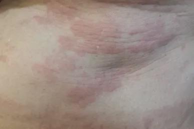 天热高发,鄞州人家中有它的要格外注意