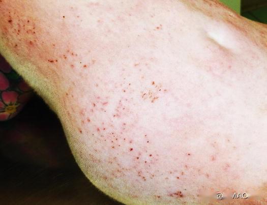 猫咪罕见疾病 色素性荨麻疹,主要是由于缺陷性肥大细胞引起