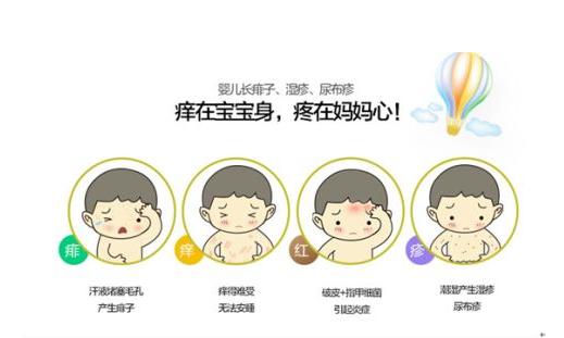 夏季宝宝湿疹不再可怕 4个实用方法轻松赶走湿疹和荨麻疹