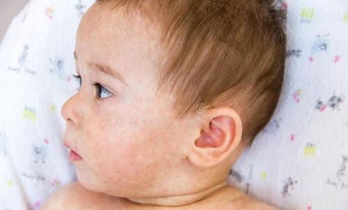 过来人经验 这4种二手婴儿用品千万不能收，别为省钱害了孩子，尤其是荨麻疹宝宝